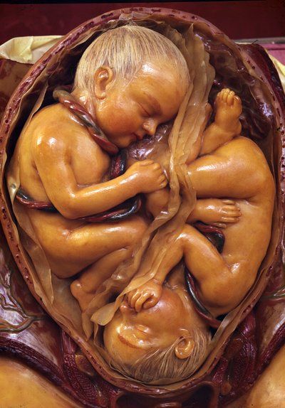 Modello di gemelli nell